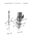 MINIMALLY INVASIVE SPINE SURGERY INSTRUMENTS: SPINAL ROD WITH FLANGE diagram and image