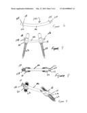 MINIMALLY INVASIVE SPINE SURGERY INSTRUMENTS: SPINAL ROD WITH FLANGE diagram and image