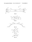 SPINAL IMPLANT SYSTEM AND METHODS OF USE diagram and image