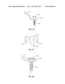 SPINAL IMPLANT SYSTEM AND METHODS OF USE diagram and image