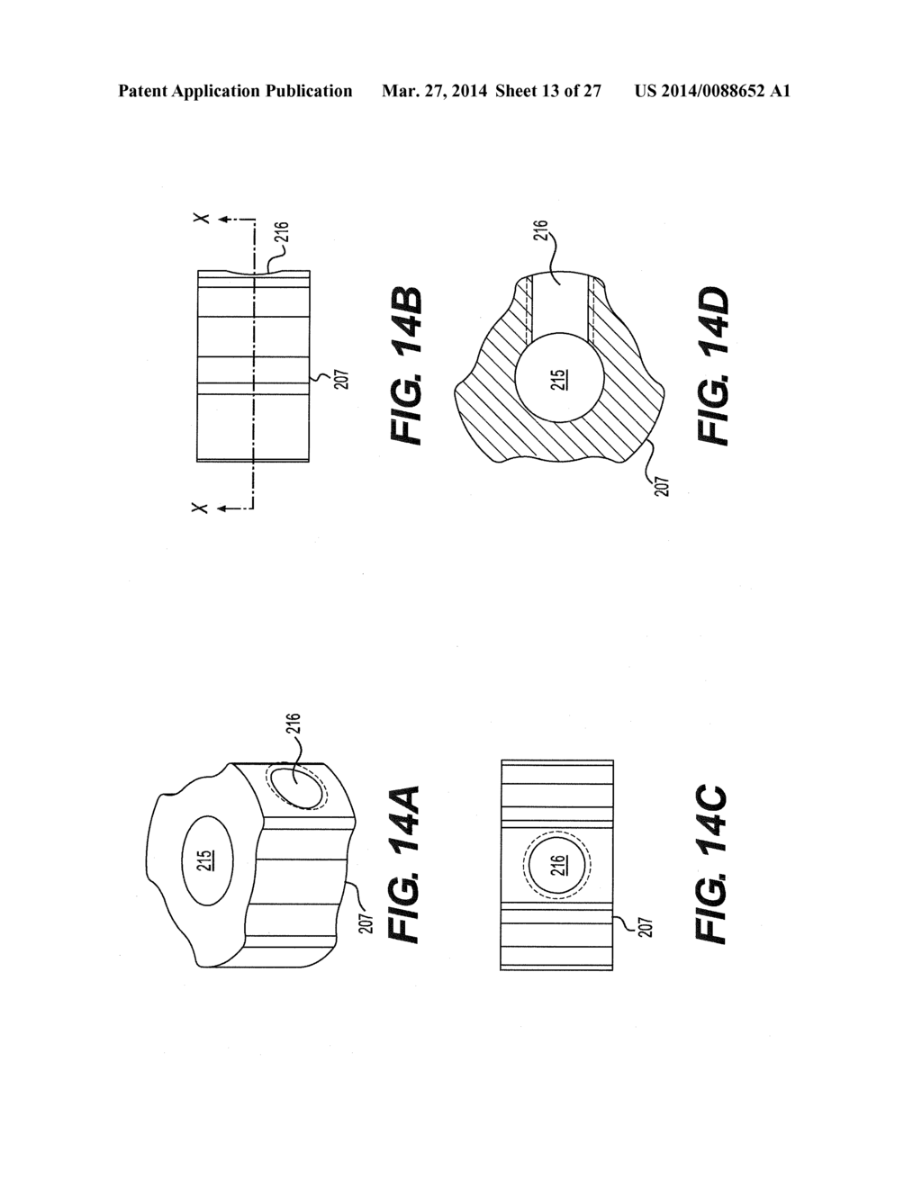 INTERNAL DYNAMIC SPLINT AND METHOD FOR USE THEREOF - diagram, schematic, and image 14