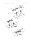 Bone Splint diagram and image