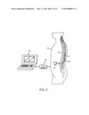 METHOD FOR EPIDURAL STIMULATION OF NEURAL STRUCTURES diagram and image