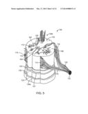 METHOD FOR EPIDURAL STIMULATION OF NEURAL STRUCTURES diagram and image