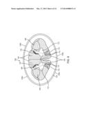 METHOD FOR EPIDURAL STIMULATION OF NEURAL STRUCTURES diagram and image