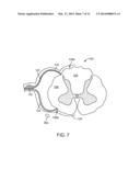 METHOD FOR EPIDURAL STIMULATION OF NEURAL STRUCTURES diagram and image