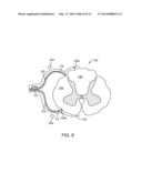 METHOD FOR EPIDURAL STIMULATION OF NEURAL STRUCTURES diagram and image