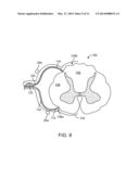 METHOD FOR EPIDURAL STIMULATION OF NEURAL STRUCTURES diagram and image