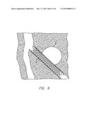 INTRAVASCULAR FLOW MODIFIER AND REINFORCEMENT DEVICE AND DEPLOYMENT SYSTEM     FOR SAME diagram and image