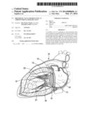 PROSTHETIC VALVE FOR REPLACING AN ATRIOVENTRICULAR HEART VALVE diagram and image