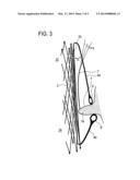 PROSTHETIC VALVE FOR REPLACING AN ATRIOVENTRICULAR HEART VALVE diagram and image