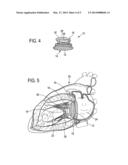 PROSTHETIC VALVE FOR REPLACING AN ATRIOVENTRICULAR HEART VALVE diagram and image