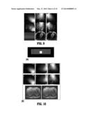 EIGEN-VECTOR APPROACH FOR COIL SENSITIVITY MAPS ESTIMATION diagram and image