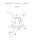 MANAGING AN ACTIVE STRAP SYSTEM FOR A FACE MASK diagram and image