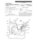 ABDOMINAL WRAP WITH WINDOW diagram and image