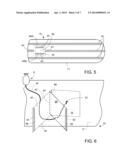 ABDOMINAL WRAP WITH WINDOW diagram and image