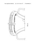 ADJUSTABLE TONGUE RETAINING ORAL APPLIANCE diagram and image