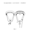 ADJUSTABLE TONGUE RETAINING ORAL APPLIANCE diagram and image