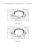 ADJUSTABLE TONGUE RETAINING ORAL APPLIANCE diagram and image