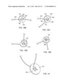 ADJUSTABLE TONGUE RETAINING ORAL APPLIANCE diagram and image