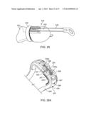 ADJUSTABLE TONGUE RETAINING ORAL APPLIANCE diagram and image