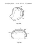 ADJUSTABLE TONGUE RETAINING ORAL APPLIANCE diagram and image