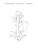 SWING WALKER diagram and image