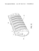 METHOD OF FABRICATION OF A WEAVE OF MATERIAL STRIPS WITHIN A METAL MESH diagram and image