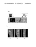 Method and System for Bone Segmentation and Landmark Detection for Joint     Replacement Surgery diagram and image