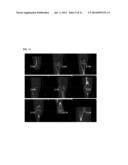 Method and System for Bone Segmentation and Landmark Detection for Joint     Replacement Surgery diagram and image