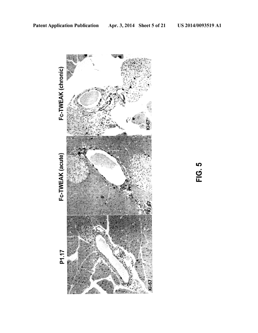 METHODS FOR PANCREATIC TISSUE REGENERATION - diagram, schematic, and image 06