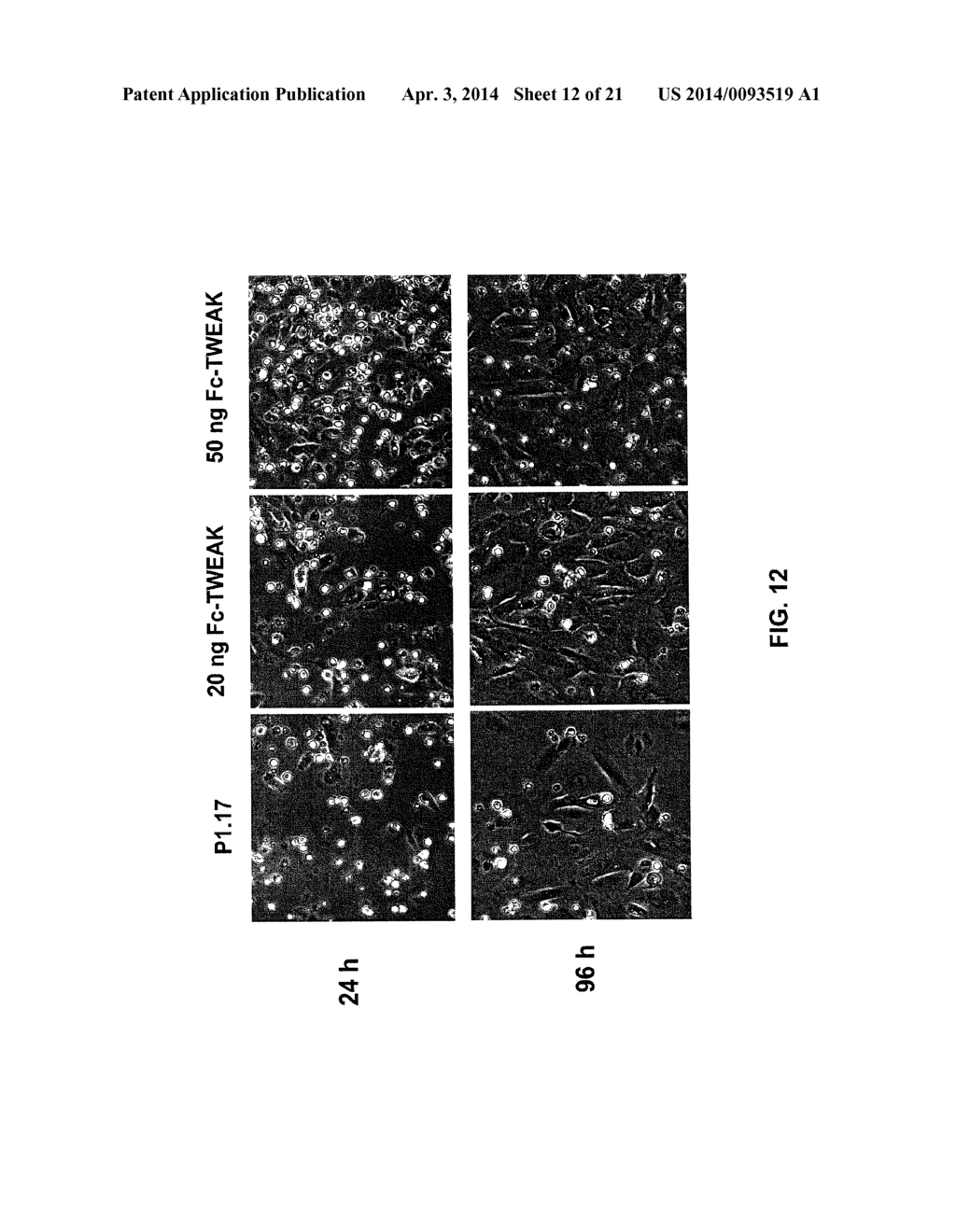 METHODS FOR PANCREATIC TISSUE REGENERATION - diagram, schematic, and image 13