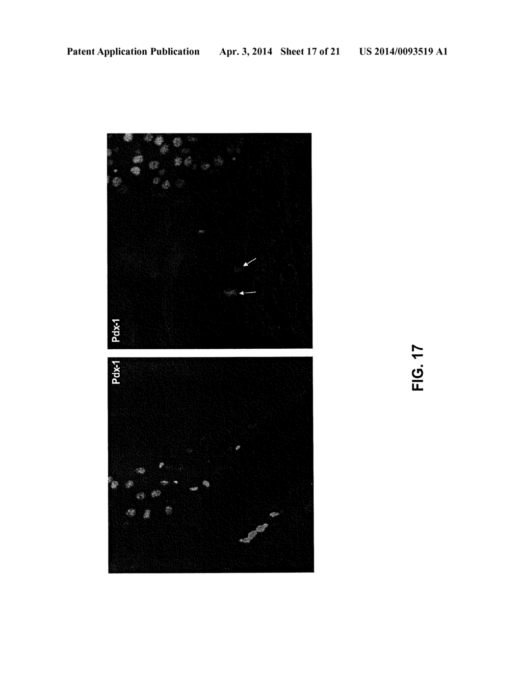 METHODS FOR PANCREATIC TISSUE REGENERATION - diagram, schematic, and image 18