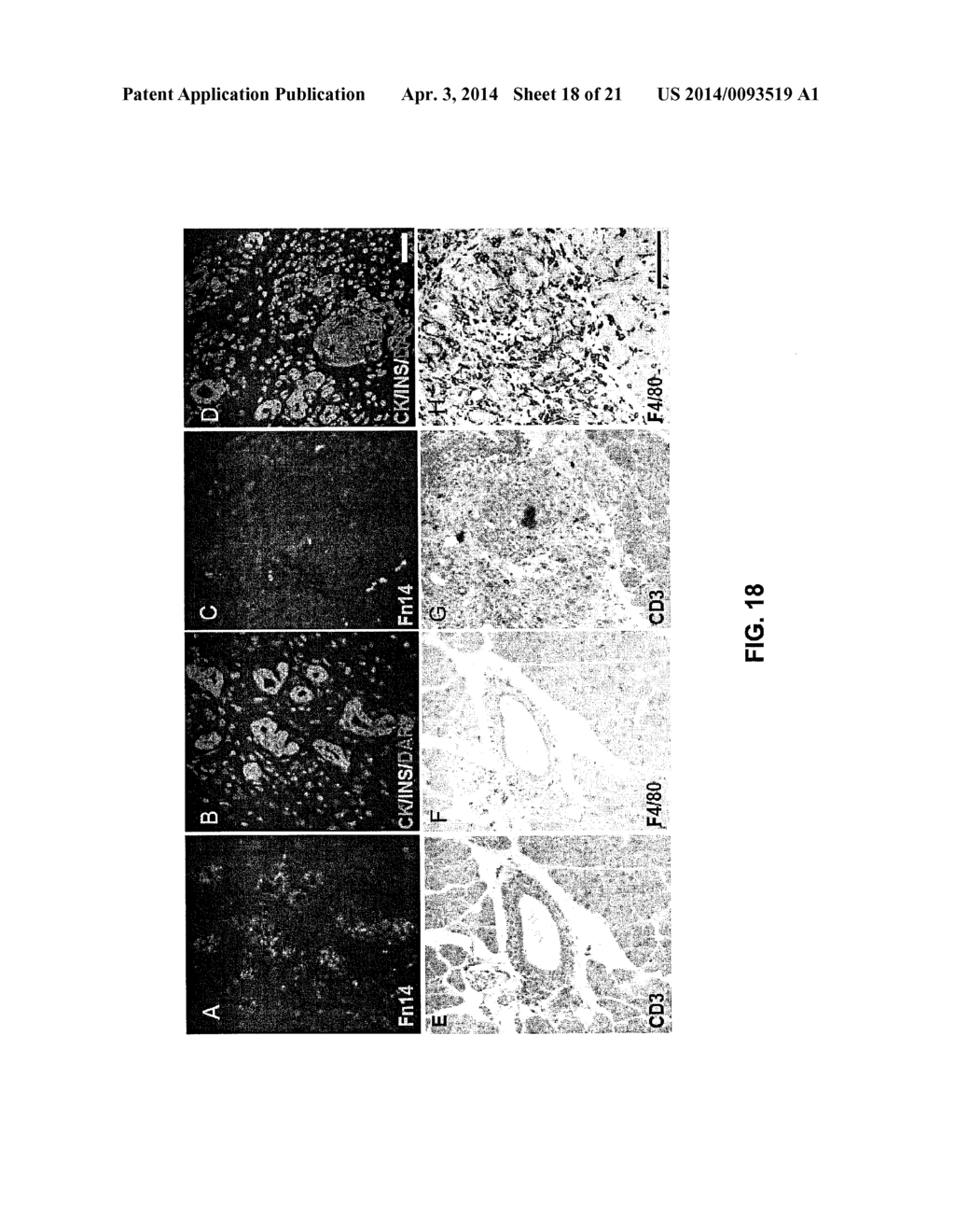 METHODS FOR PANCREATIC TISSUE REGENERATION - diagram, schematic, and image 19