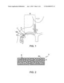 ACTIVE MATERIALS FOR PREVENTION AND TREATMENT OF FOULED SURFACES diagram and image