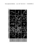 MARKER COMPRISING ANTI-CK8/18 COMPLEX AUTOANTIBODY AND ITS USE FOR     DIAGNOSING CANCER diagram and image