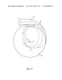 ADJUSTING ENERGY OF A PARTICLE BEAM diagram and image