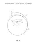 ADJUSTING ENERGY OF A PARTICLE BEAM diagram and image