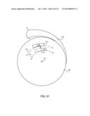 ADJUSTING ENERGY OF A PARTICLE BEAM diagram and image