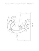 Controlling Particle Therapy diagram and image