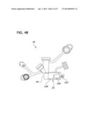 Feeding Tube System with Imaging Assembly and Console Connector diagram and image