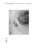 Feeding Tube System with Imaging Assembly and Console Connector diagram and image