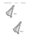 METHOD OF ASSESSING CAPSULAR FORMATION AND/OR CONTRACTURE diagram and image