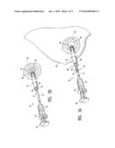 CAVITY FILLING BIOPSY SITE MARKERS diagram and image