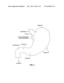 SATIATION DEVICES AND METHODS diagram and image