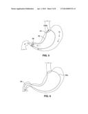 SATIATION DEVICES AND METHODS diagram and image