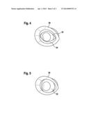 Guide Device for Intraocular Injection diagram and image