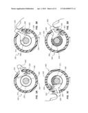 ADJUSTABLE LENGTH CATHETER AND METHOD OF USE diagram and image