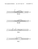 DUAL PURPOSE BALLOON CATHETERS diagram and image