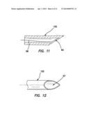 SYSTEMS AND METHODS FOR CREATING ARTERIOVENOUS (AV) FISTULAS diagram and image